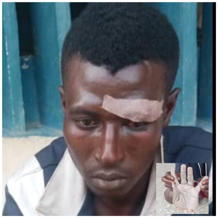 The suspect, Usman Danladi (Chopped wrist insert).